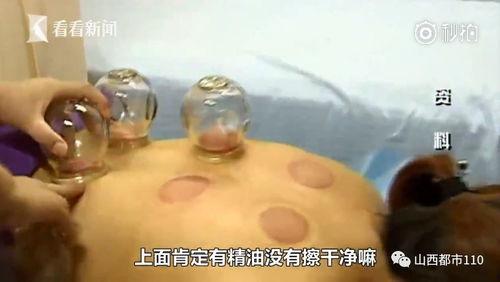 拔罐视频,揭秘拔罐神奇疗效的瞬间